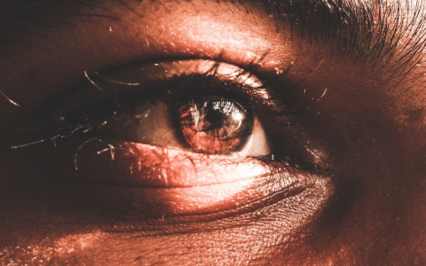 Quais são os erros de refração ocular?