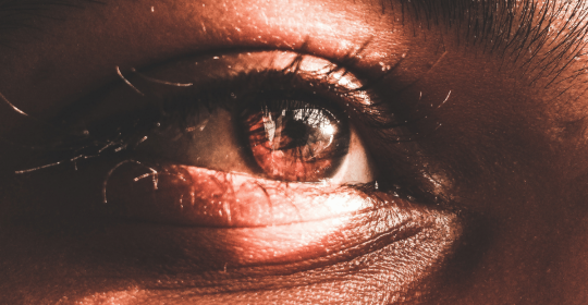 Quais são os erros de refração ocular?