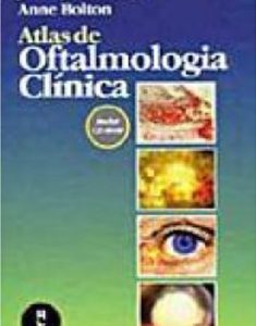 Nome Do Livro: Atlas de Oftalmologia Clínica Autor: JACK J. KANSKI e ANNE BOLTON Editor: Artmed
